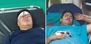 स्वास्थ्य सामाग्री लिएर सुर्खेत पुगेका ज्ञानेन्द्र शाहीको टिम माथि कुटपिट