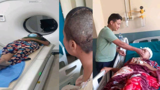 मगर संसारको पहलमा रोल्पाकी ब्रेन ट्यूमर बिरामीलाई आर्थिक सहयोग